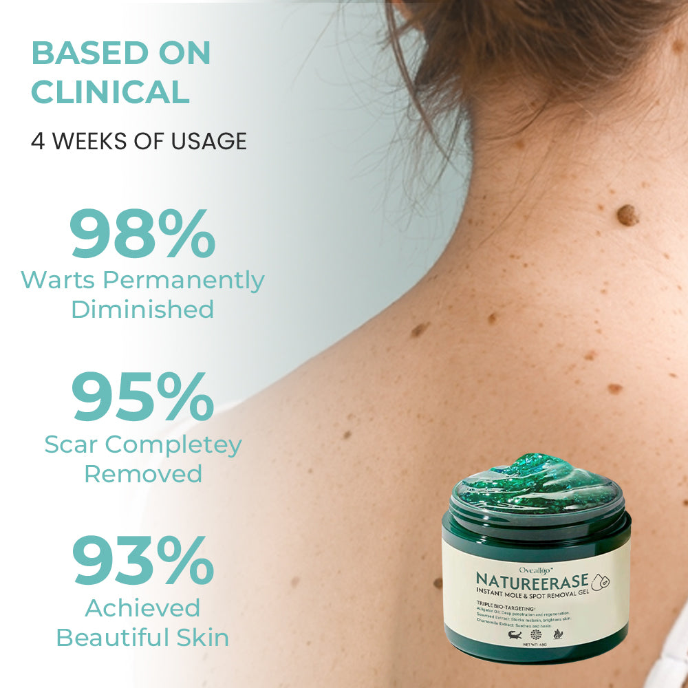 ✅ Official Store: Oveallgo™ Ultra NatureErase Instant Mole & Spot Removal Gel