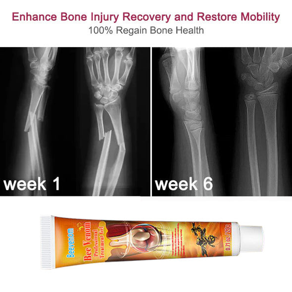 Flashing® New Zealand Bee Venom Professional Treatment (Full Body Recovery, Pure Natural Formula)