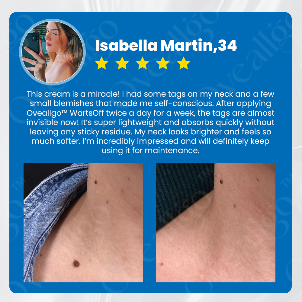 ✅ Official Store: Oveallgo™ NEW WartsOff Instant Blemish Removal Cream👩⚕️USA Dermatology Association (AADA)Approved (Skin Tags, Warts, Dark Spots Removal)